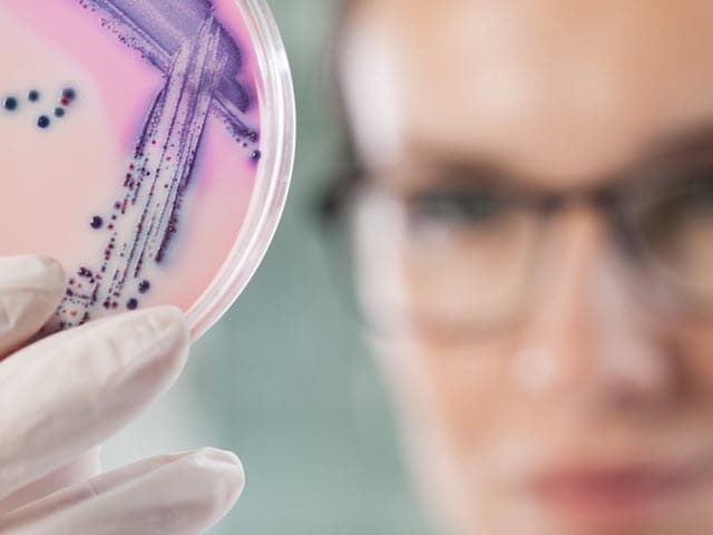 pharma-cmc-product-development-microbiological-480x640